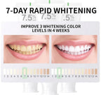 Nano - Hyrdroxyapatite 7.5% Recovery Tooth Paste